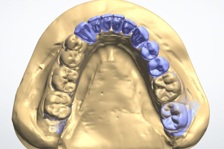 Progetti implantari software guidati